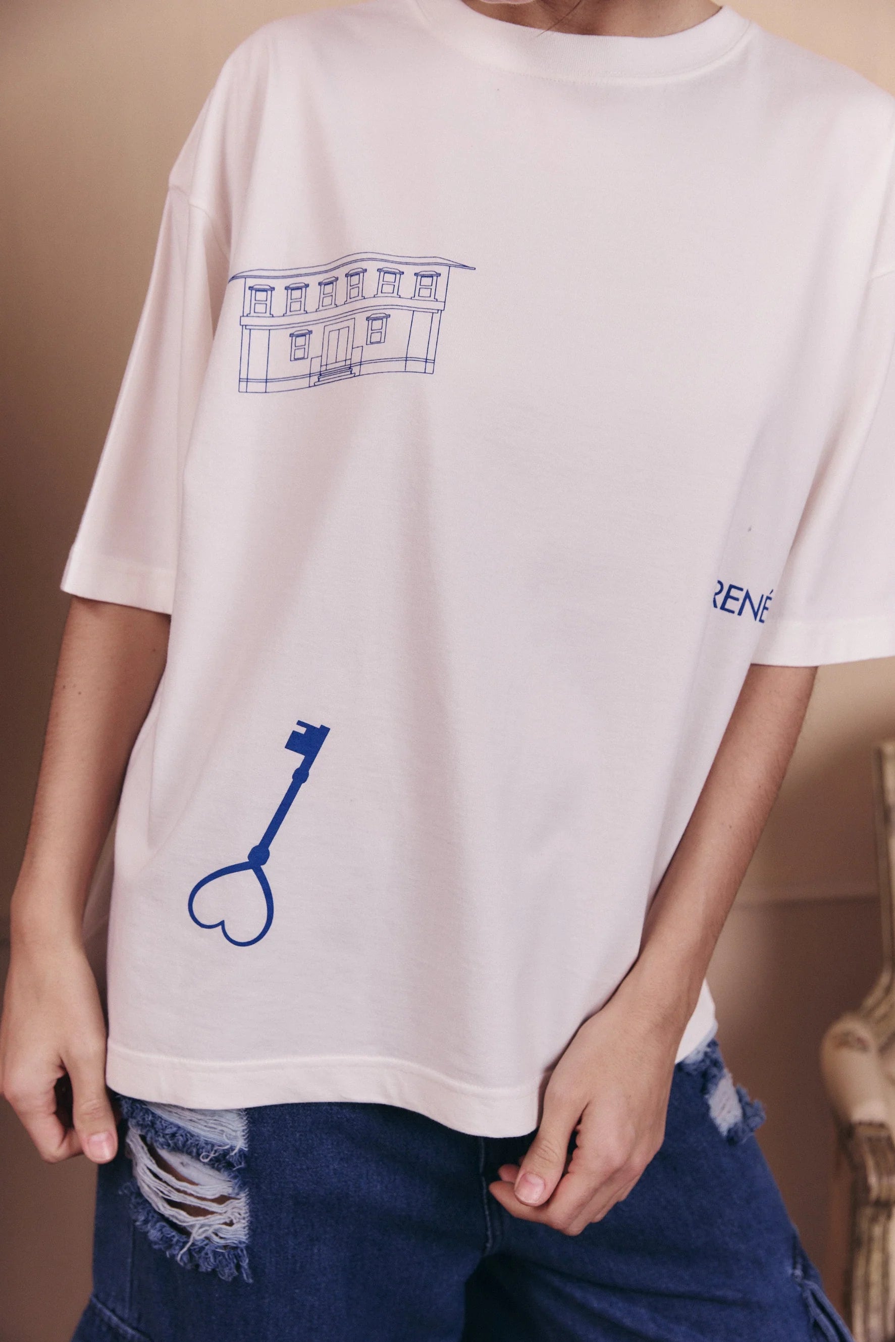REMERÓN MAGNÉTICO